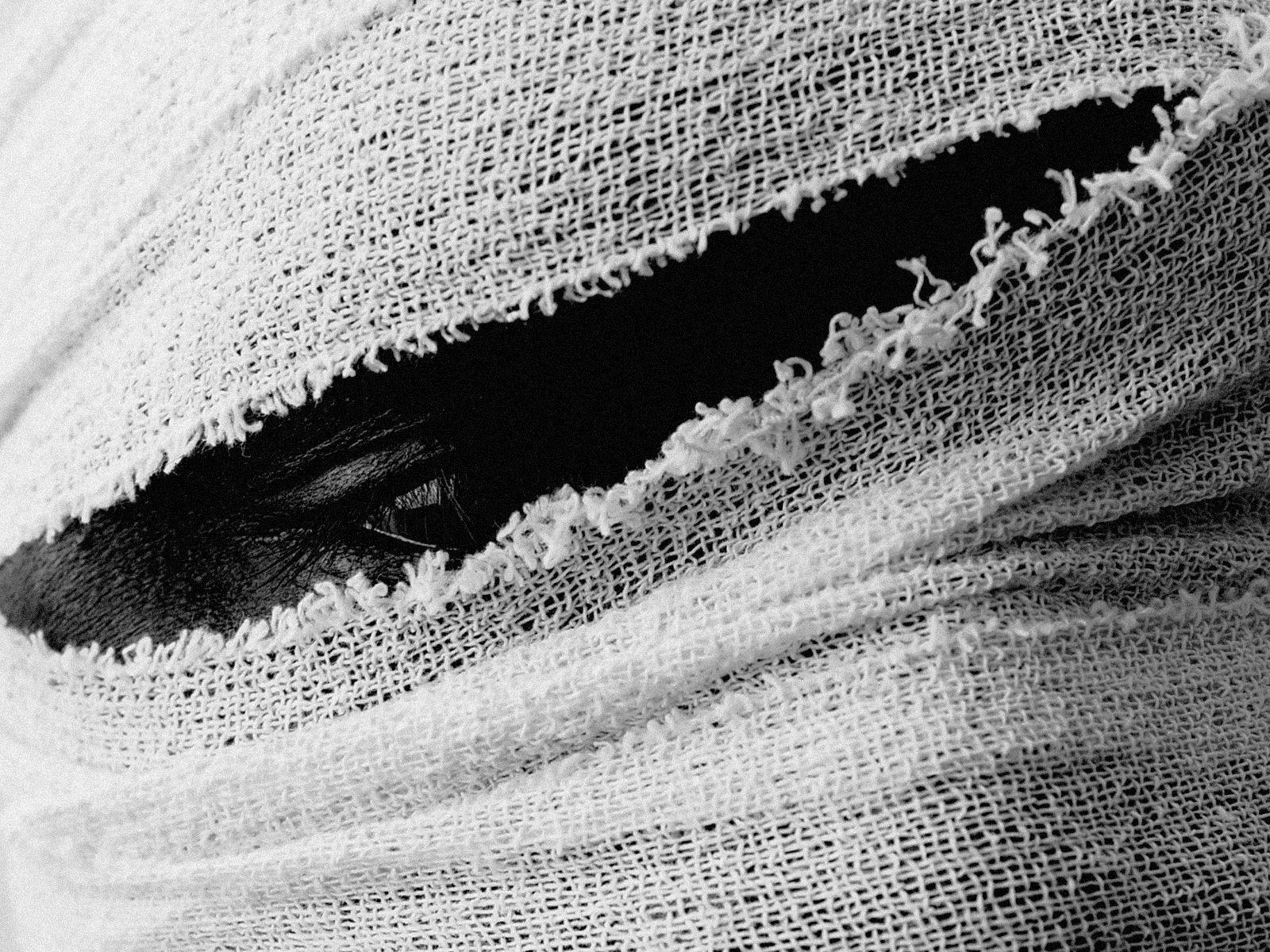 A closeup of a persons face completely wrapped in bandages, through a small slit you can an eye.